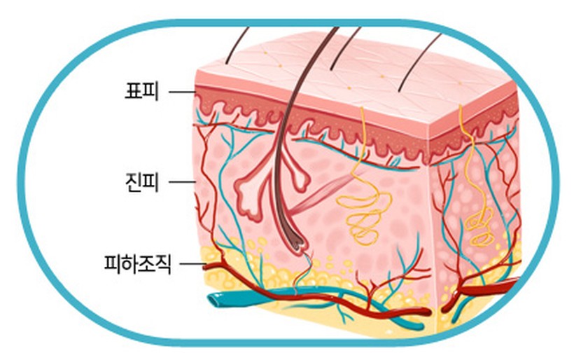 자가진피 일러스트