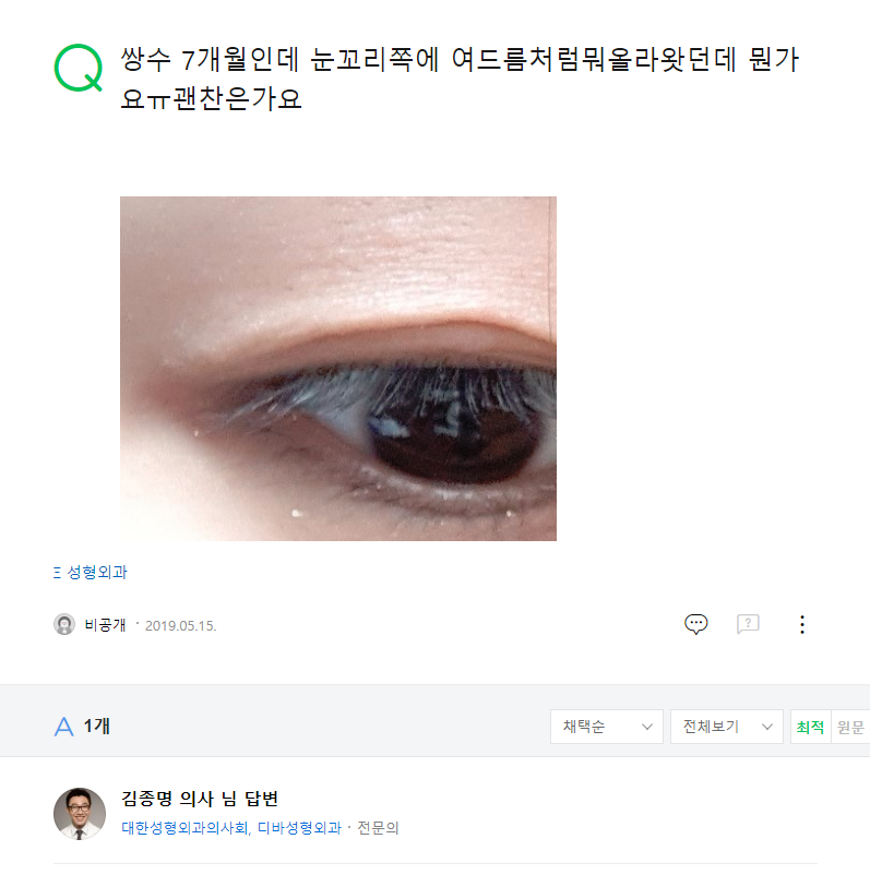 쌍수 7개월인데 눈꼬리쪽에 여드름처럼뭐올라왓던데 뭔가요ㅠ괜찬은가요 네이버 지식인 상담 원문
