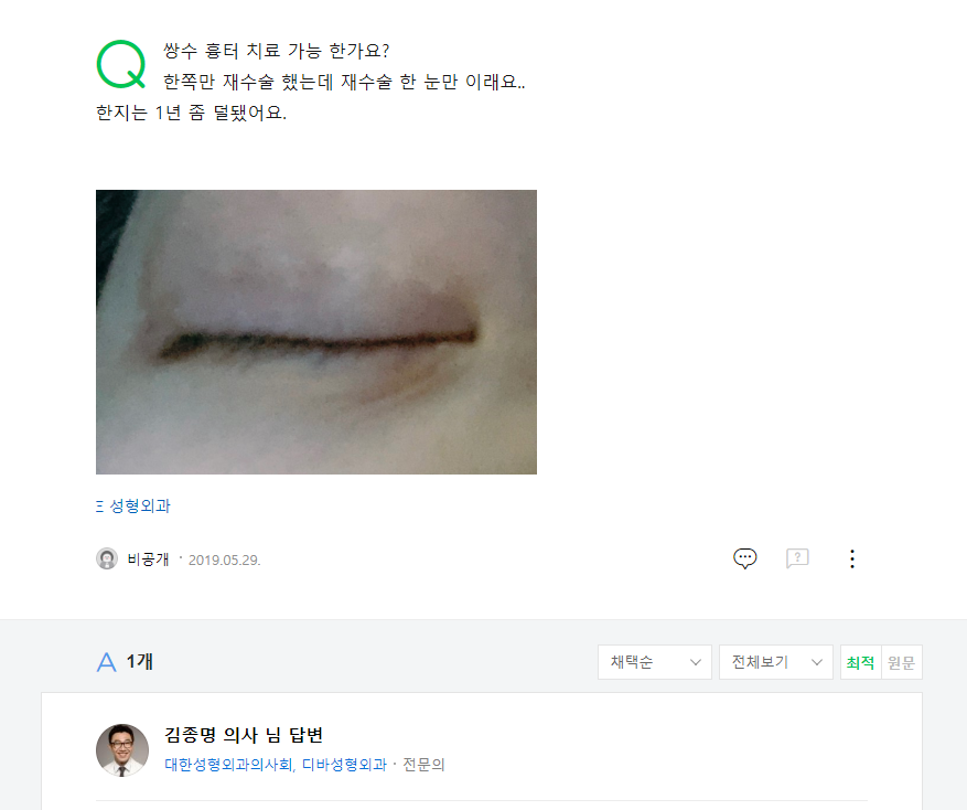 쌍수 흉터 치료 가능 한가요? 네이버 지식인 상담 원문